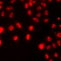 Histone H3 (DiMethyl-K79) Rabbit Polyclonal Antibody