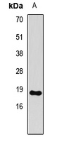 Histone H3 (DiMethyl-K79) Rabbit Polyclonal Antibody