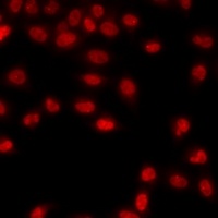 Histone H3 (DiMethyl-K79) Rabbit Polyclonal Antibody