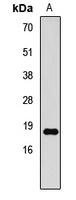 Histone H3 (DiMethyl-K79) Rabbit Polyclonal Antibody