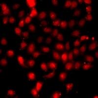 Histone H3 (DiMethyl-K79) Rabbit Polyclonal Antibody