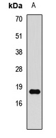 Histone H3 (DiMethyl-K79) Rabbit Polyclonal Antibody