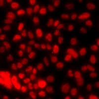 Histone H3 (DiMethyl-K79) Rabbit Polyclonal Antibody