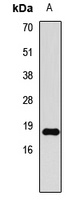 Histone H3 (Symmetric DiMethyl-R8) Rabbit Polyclonal Antibody