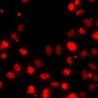 Histone H3 (Symmetric DiMethyl-R8) Rabbit Polyclonal Antibody