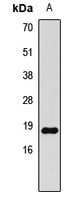 Histone H3 (Symmetric DiMethyl-R8) Rabbit Polyclonal Antibody