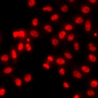 Histone H3 (Symmetric DiMethyl-R8) Rabbit Polyclonal Antibody