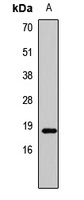 Histone H3 (Symmetric DiMethyl-R8) Rabbit Polyclonal Antibody