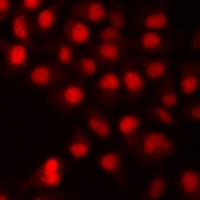 Histone H3 (Symmetric DiMethyl-R8) Rabbit Polyclonal Antibody
