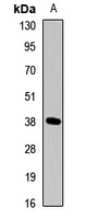 DKK3 Rabbit Polyclonal Antibody