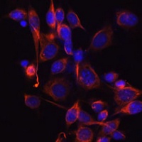 DKK3 Rabbit Polyclonal Antibody