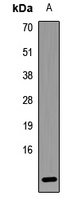 LAMTOR5 Rabbit Polyclonal Antibody