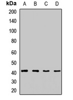 DLK1 Rabbit Polyclonal Antibody
