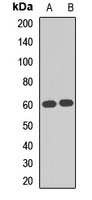 HSF2 Rabbit Polyclonal Antibody