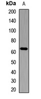 IGF2BP2 Rabbit Polyclonal Antibody