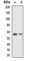 DNAJC7 Rabbit Polyclonal Antibody