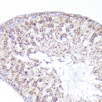 PEG10 Rabbit Polyclonal Antibody