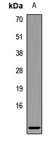 CCL3L1 Rabbit Polyclonal Antibody