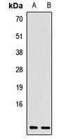 CCL17 Rabbit Polyclonal Antibody