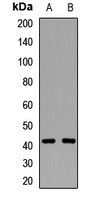 CD192 Rabbit Polyclonal Antibody