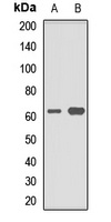 EAAT4 Rabbit Polyclonal Antibody