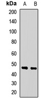 GFRA3 Rabbit Polyclonal Antibody