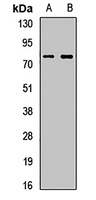 Pleiotrophin Rabbit Polyclonal Antibody