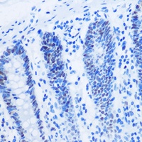 Histone H3 (MonoMethyl-R26) Rabbit Polyclonal Antibody