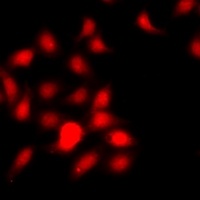 Histone H3 (MonoMethyl-R26) Rabbit Polyclonal Antibody