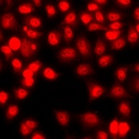 Histone H3 (MonoMethyl-R26) Rabbit Polyclonal Antibody