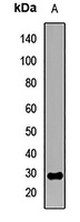 Neurotrophin 3 Rabbit Polyclonal Antibody