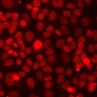 SETD2 Rabbit Polyclonal Antibody