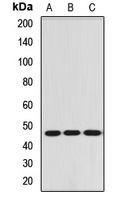 RBM17 Rabbit Polyclonal Antibody