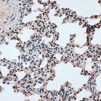 RBM17 Rabbit Polyclonal Antibody