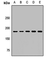 RhoGAP5 Rabbit Polyclonal Antibody