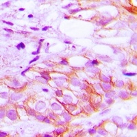 LRP2 Rabbit Polyclonal Antibody