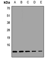COX6A1 Rabbit Polyclonal Antibody