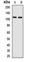 CYLD Rabbit Polyclonal Antibody