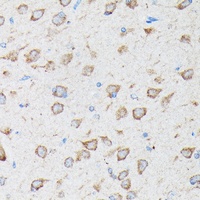 CYLD Rabbit Polyclonal Antibody
