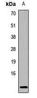 Hemoglobin epsilon Rabbit Polyclonal Antibody