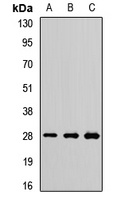 PSMA7 Rabbit Polyclonal Antibody