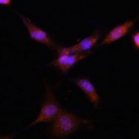 PSMA7 Rabbit Polyclonal Antibody