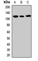 USP5 Rabbit Polyclonal Antibody