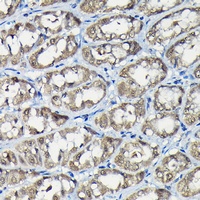 USP5 Rabbit Polyclonal Antibody
