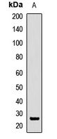 SFRS9 Rabbit Polyclonal Antibody
