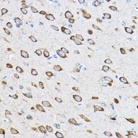 RPL23 Rabbit Polyclonal Antibody