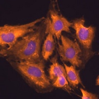 RPL23 Rabbit Polyclonal Antibody