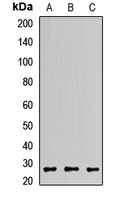 GS27 Rabbit Polyclonal Antibody