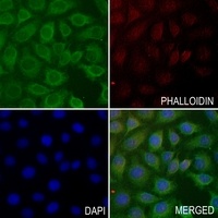 PIEZO1 Rabbit Polyclonal Antibody