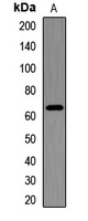 IGF2BP3 Rabbit Polyclonal Antibody